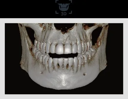 3D dental imaging showing a frontal view of the skull with a full set of teeth for Tooth Suite Maine
