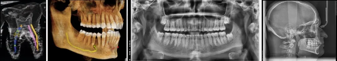 Series of dental X-rays and 3D scans showing detailed views of teeth and jaw structures, featured on the Tooth Suite Maine page