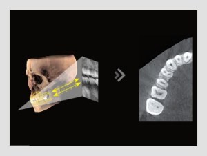 3D dental imaging with cross-sectional views highlighting teeth and jaw alignment, featured on the Tooth Suite Maine page