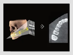 3D dental imaging with cross-sectional views highlighting teeth and jaw alignment, featured on the Tooth Suite Maine page